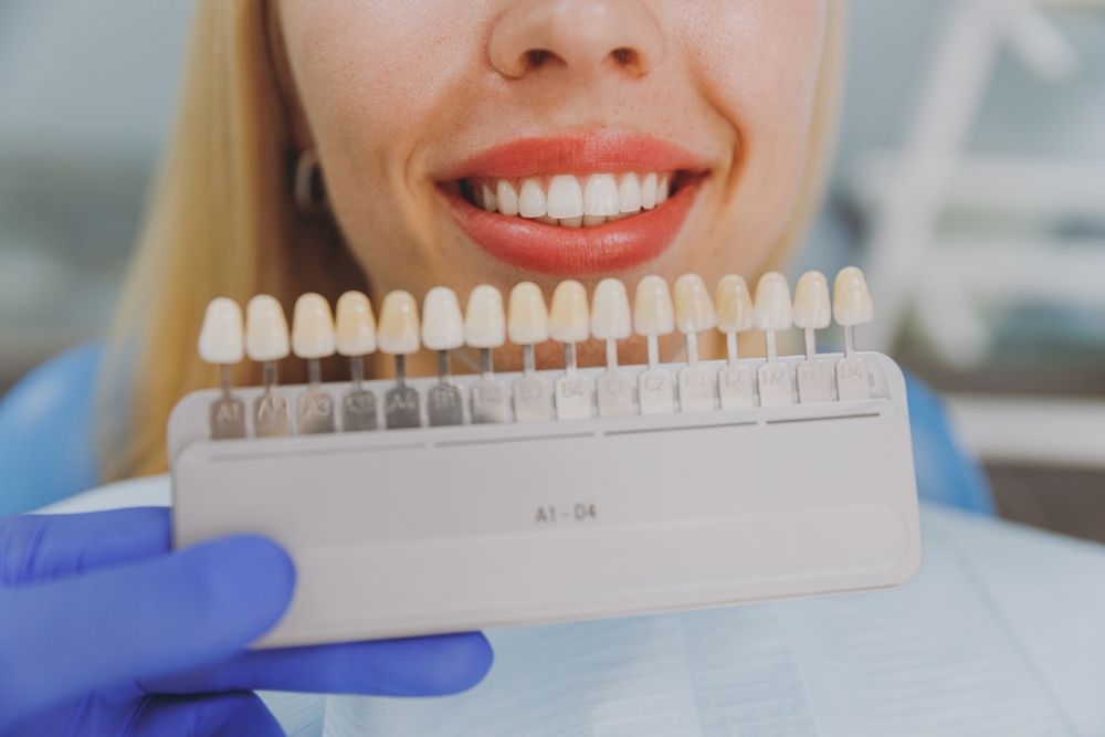 Close up cropped young smiling woman choosing veneers enamel color compare teeth shade sit at dentist office chair indoor light modern cabinet near stomatologist Healthcare enamel whitening treatment